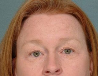 Case # 5 before photo