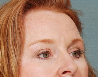 Case # 5 after photo