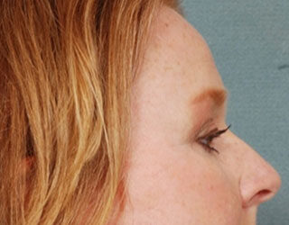 Case # 5 after photo