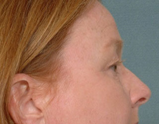 Case # 5 before photo