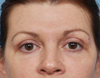 Case # 3 after photo