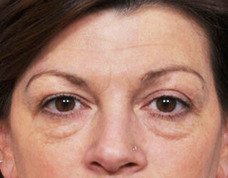 Case # 3 before photo