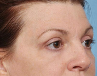 Case # 3 after photo