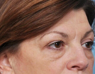 Case # 3 before photo