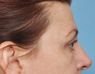 Case # 3 after photo