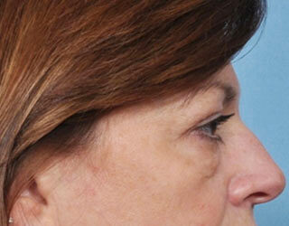 Case # 3 before photo