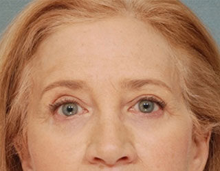 Case # 4 after photo