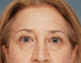 Case # 4 before photo