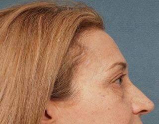 Case # 4 before photo