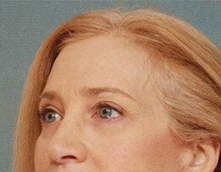 Case # 4 after photo