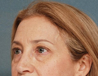 Case # 4 before photo