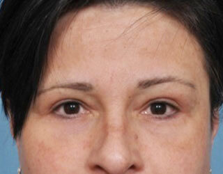 Case # 1 after photo