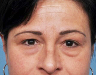 Case # 1 before photo