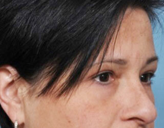 Case # 1 after photo