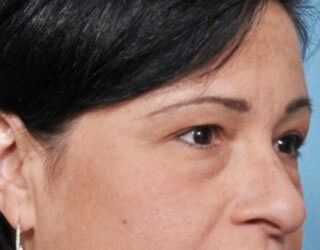 Case # 1 before photo