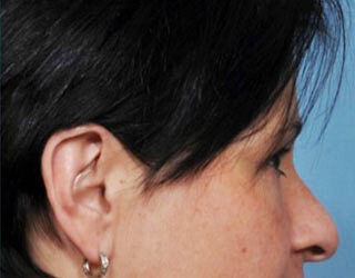 Case # 1 after photo