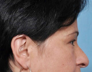 Case # 1 before photo