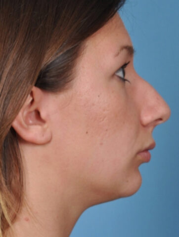 Case # 2 before photo