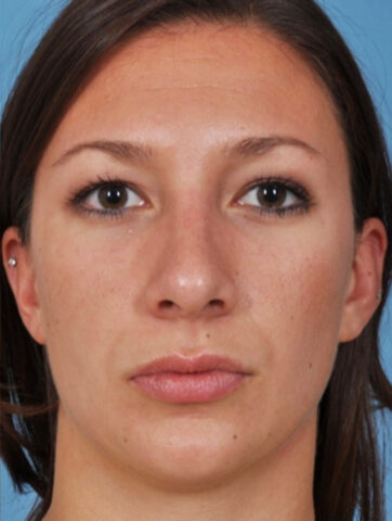 Case # 2 after photo