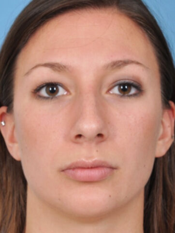 Case # 2 before photo