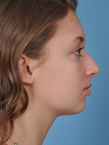 Case # 4 before photo