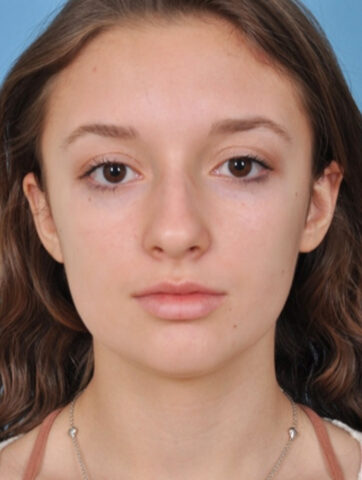 Case # 4 before photo