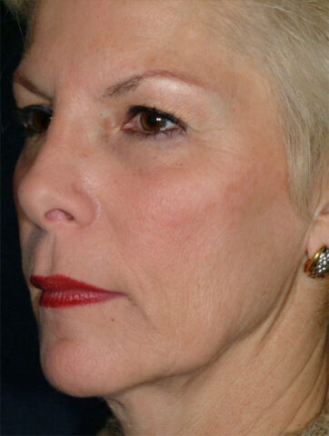 Case # 3 before photo