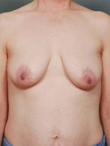 Case # 29 before photo