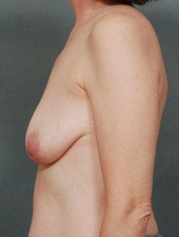 Case # 29 before photo