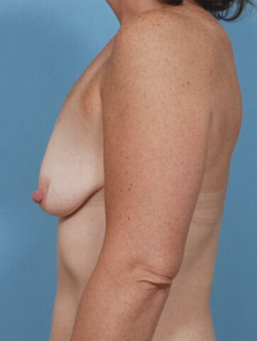 Case # 27 before photo