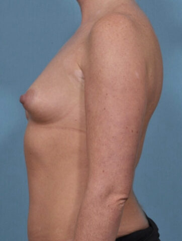 Case # 25 before photo