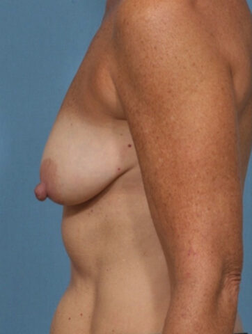 Case # 31 before photo