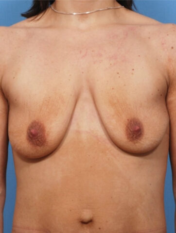 Case # 36 before photo