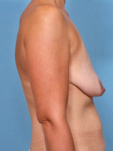 Case # 7 before photo