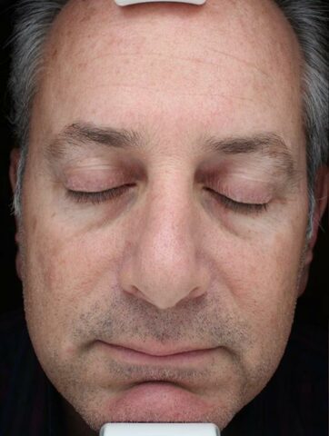 Case # 50 before photo