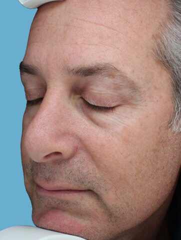 Case # 50 before photo