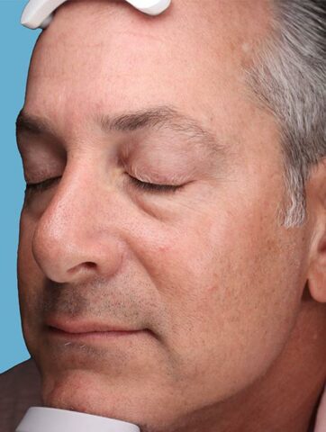 Case # 50 after photo