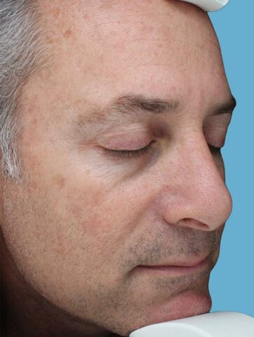 Case # 50 before photo