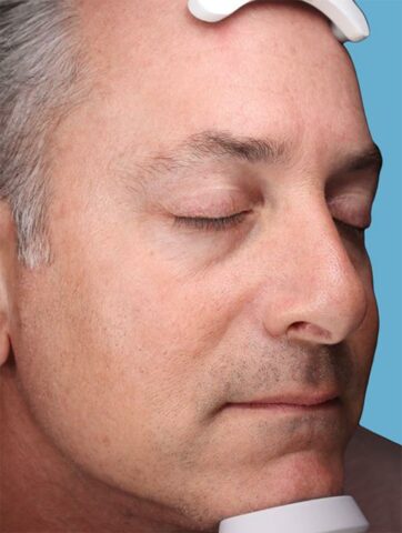 Case # 50 after photo