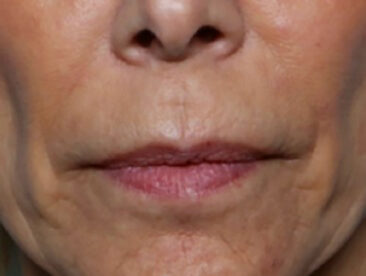 Case # 1 before photo