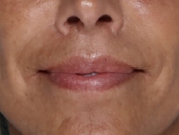 Case # 1 after photo