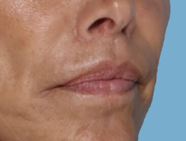 Case # 1 after photo