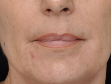 Case # 2 before photo