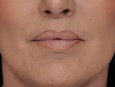 Case # 2 after photo