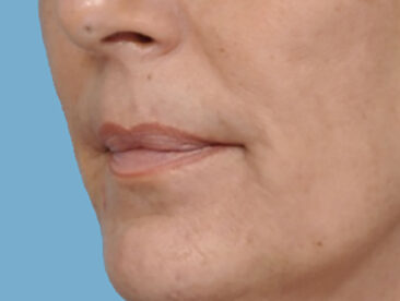 Case # 2 before photo