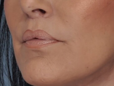 Case # 2 after photo