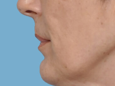 Case # 2 before photo