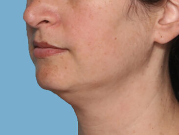 Case # 2 before photo