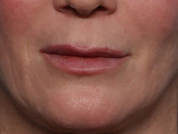 Case # 3 before photo