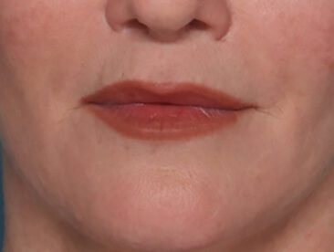 Case # 3 after photo